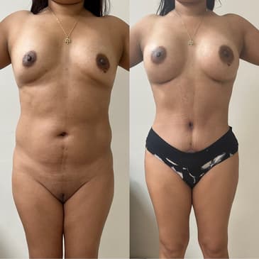 Slider image (9) Dr. Gabriel Sandoval - Plastic Surgeon in Mexico